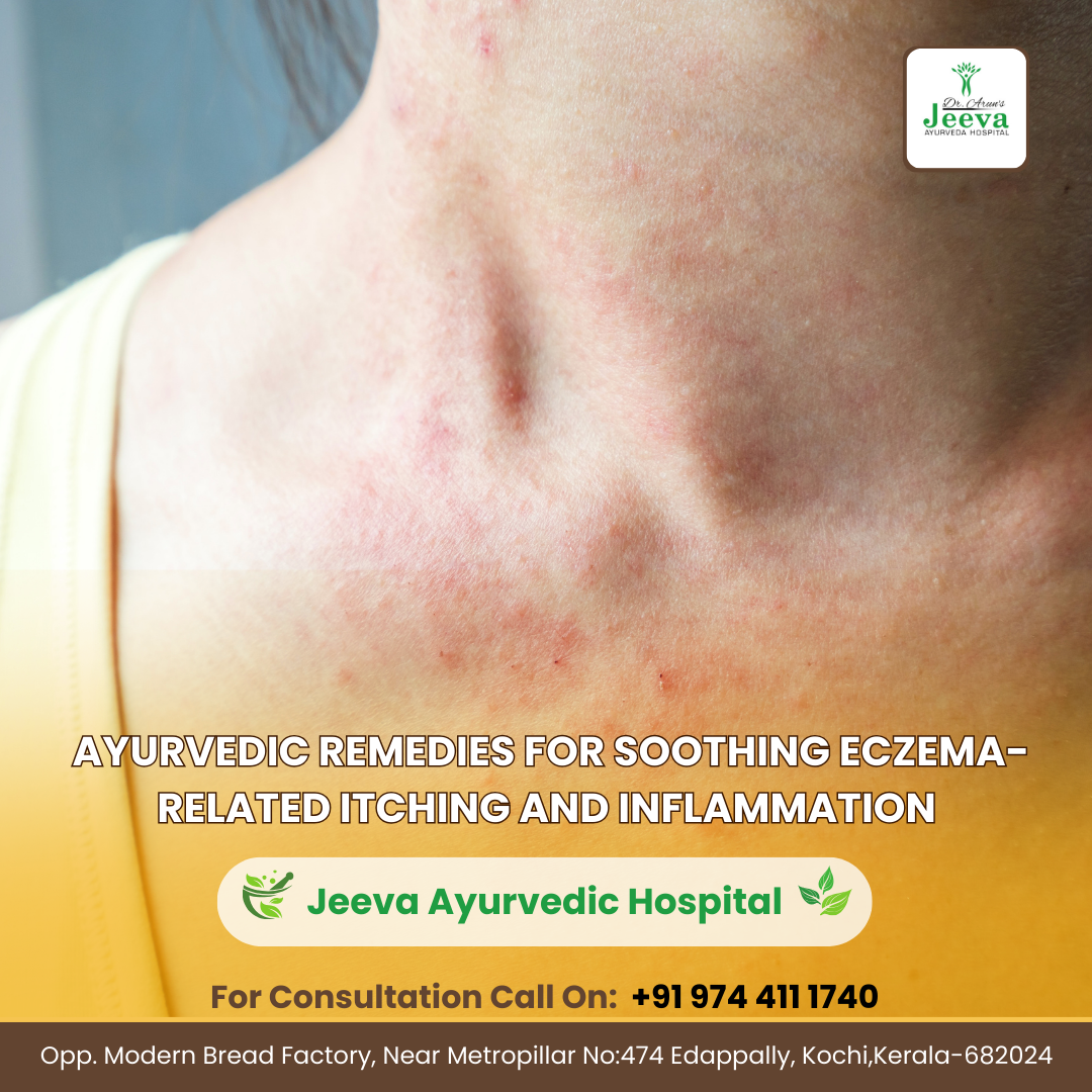 Ayurvedic remedies for eczema